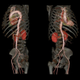 Image for article titled You Won't Believe How Accurate GE's New CT Scanner Is